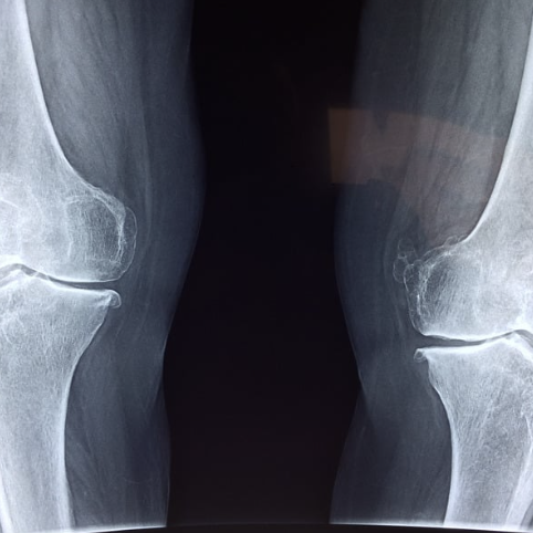 xrays near me